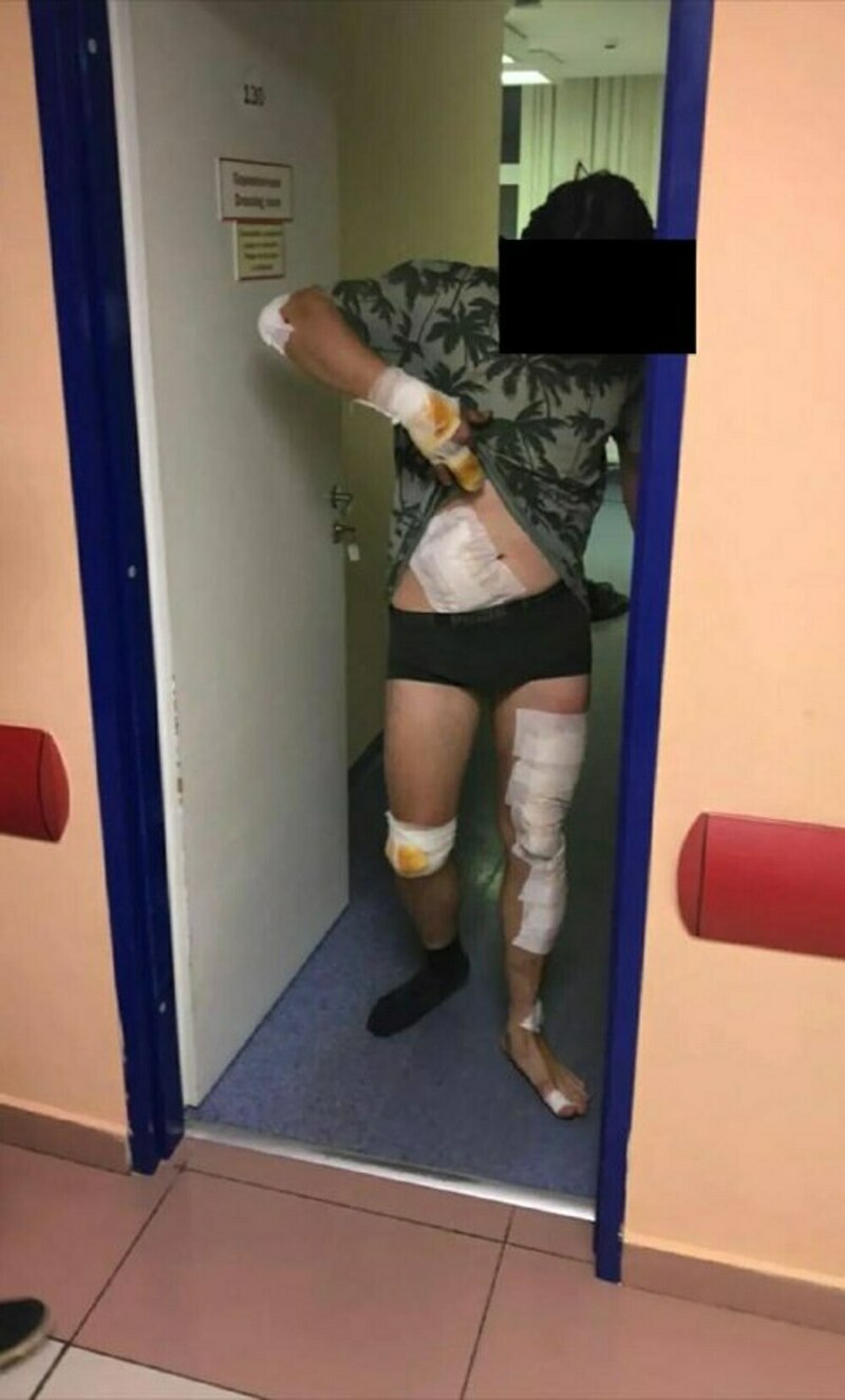 Мотоциклист попавший в аварию